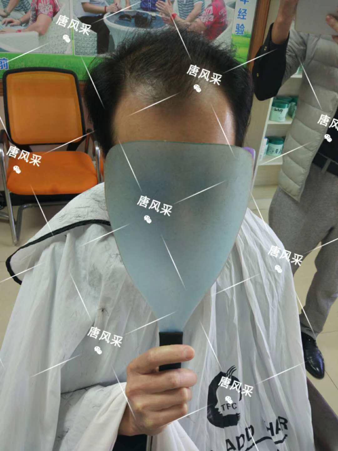 脫發(fā)謝頂壓力大，增發(fā)補(bǔ)發(fā)一身輕！