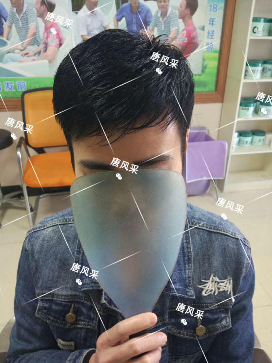 脫發(fā)謝頂壓力大，增發(fā)補(bǔ)發(fā)一身輕！