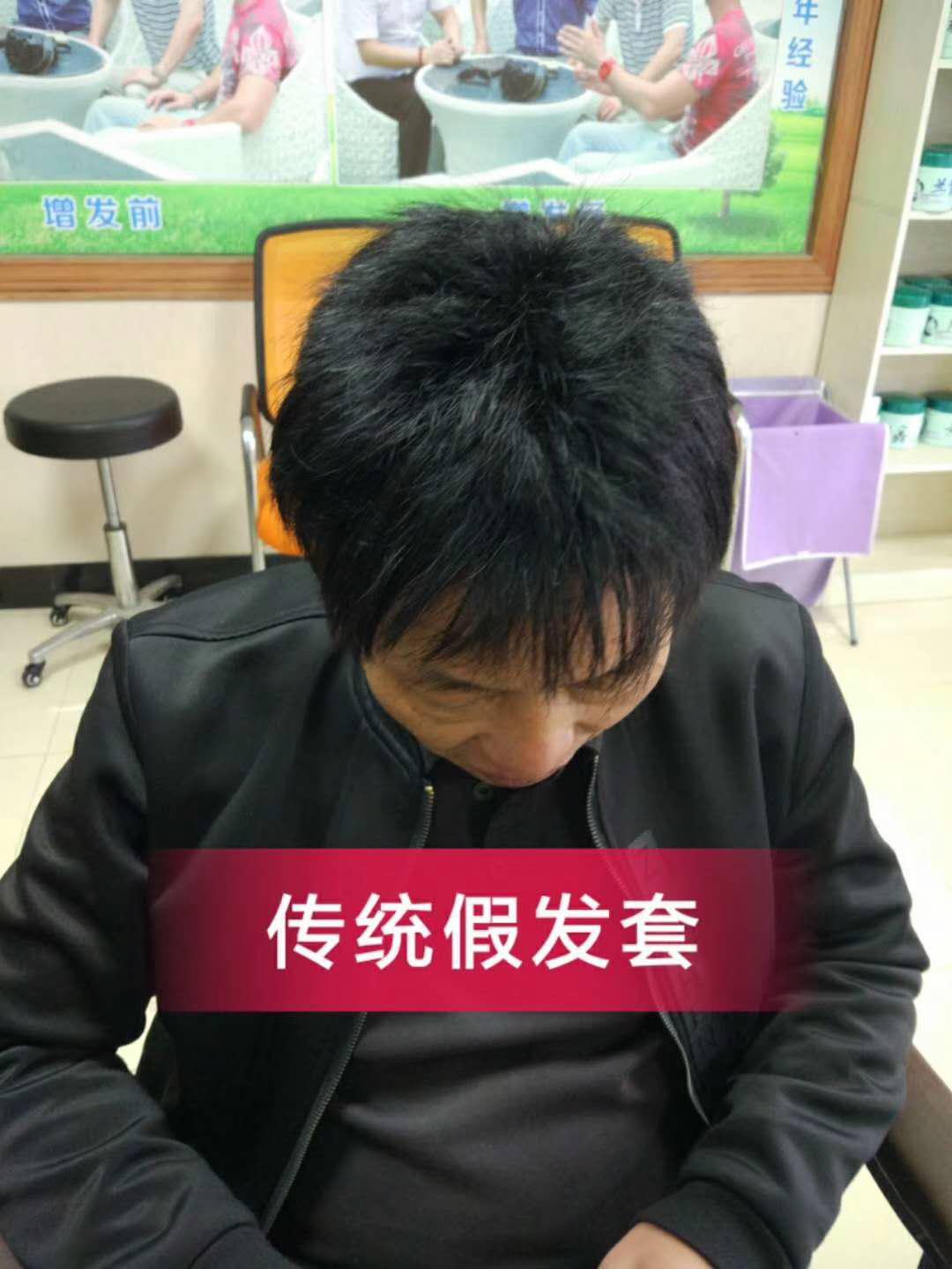 脫發(fā)謝頂壓力大，增發(fā)補(bǔ)發(fā)一身輕！