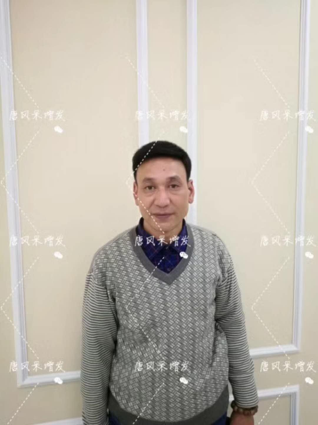 我的天吶！沒想到某防脫洗發(fā)水的老板居然也脫發(fā)了！