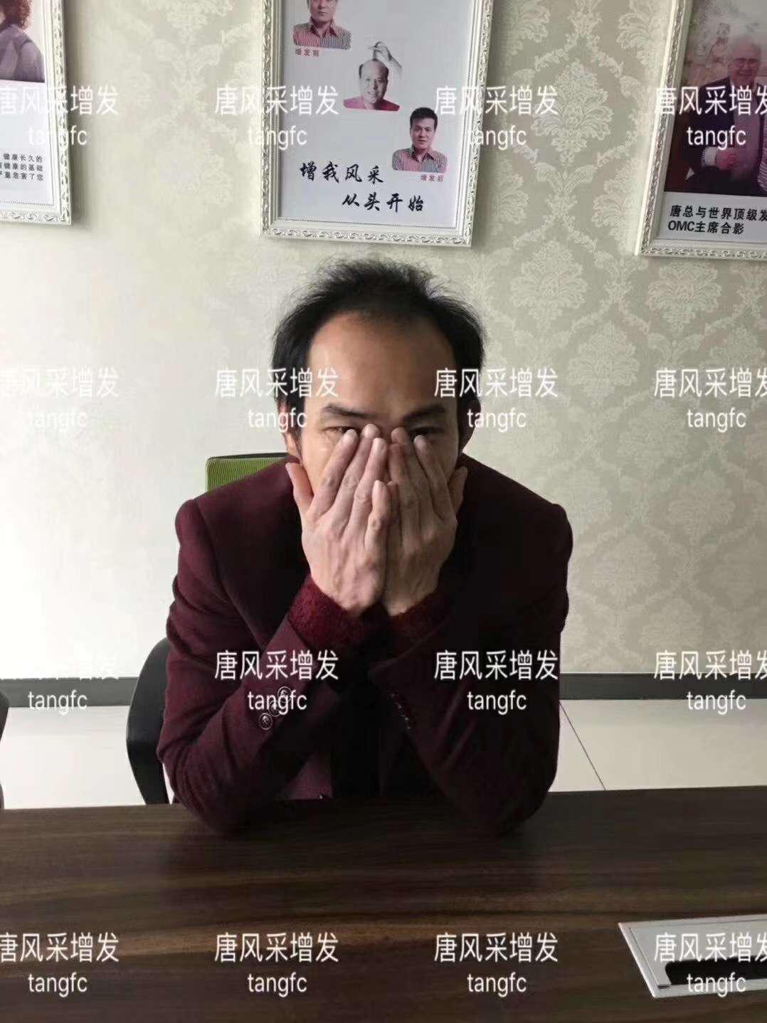 一轉(zhuǎn)眼年輕十歲，你差的就是這點(diǎn)點(diǎn)頭發(fā)！