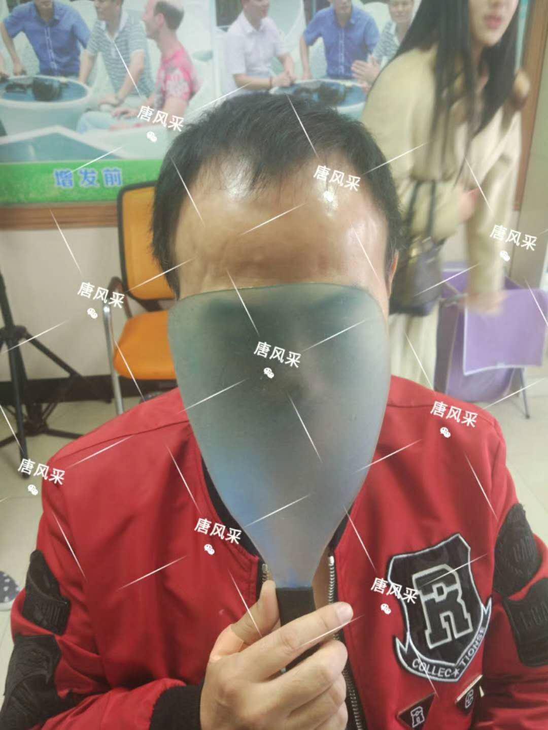  一轉(zhuǎn)眼年輕十歲，你差的就是這點(diǎn)點(diǎn)頭發(fā)！