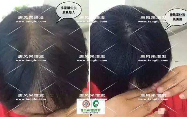 女士假發(fā)見證華麗轉(zhuǎn)變，前后差別震撼！