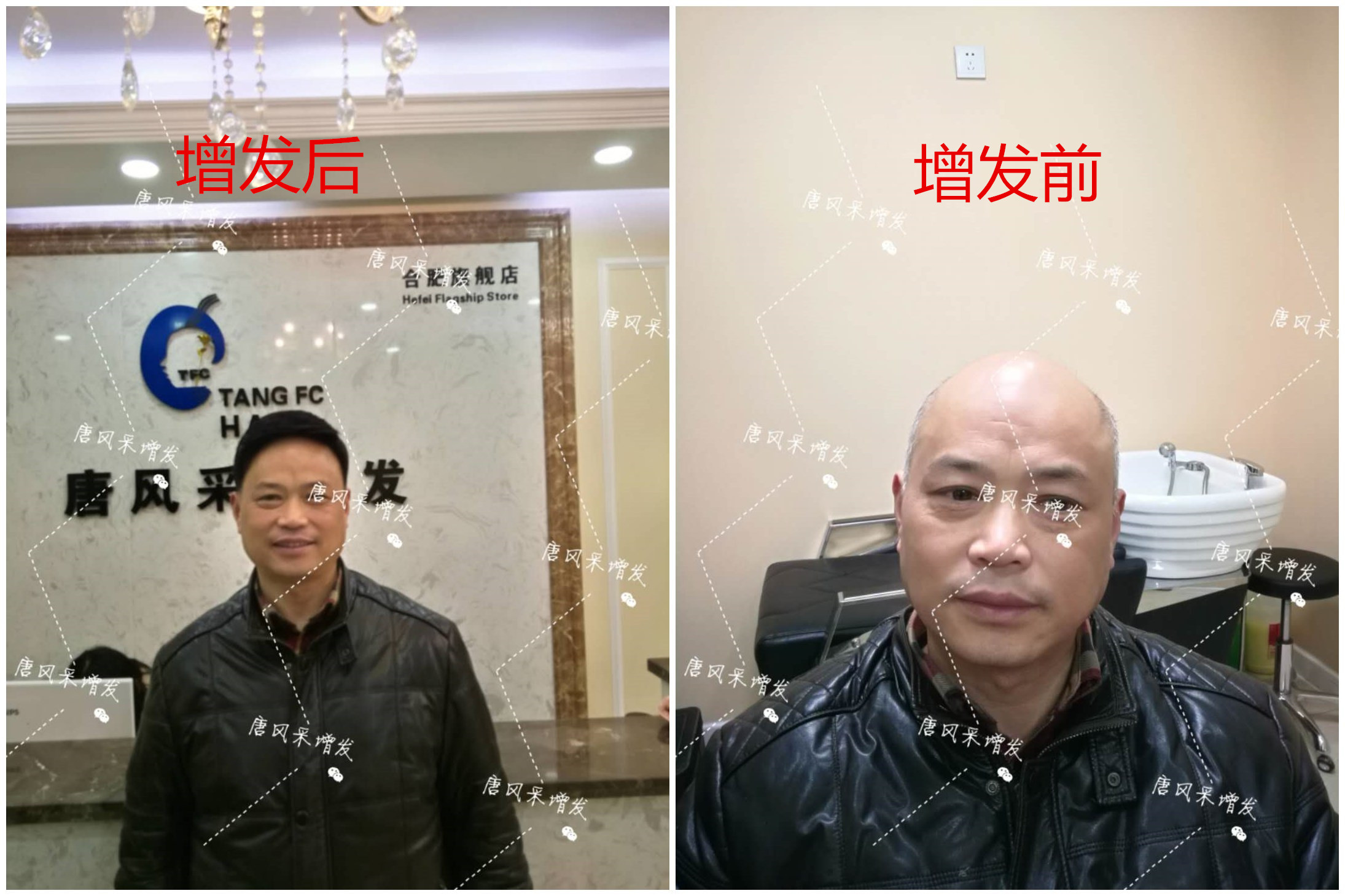 我想知道，在唐風(fēng)采假發(fā)之后，真實客戶是如何評價的？