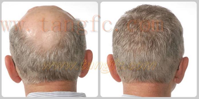 蘭州哪里有賣假發(fā)的？質(zhì)量好嗎？?jī)r(jià)格怎樣？