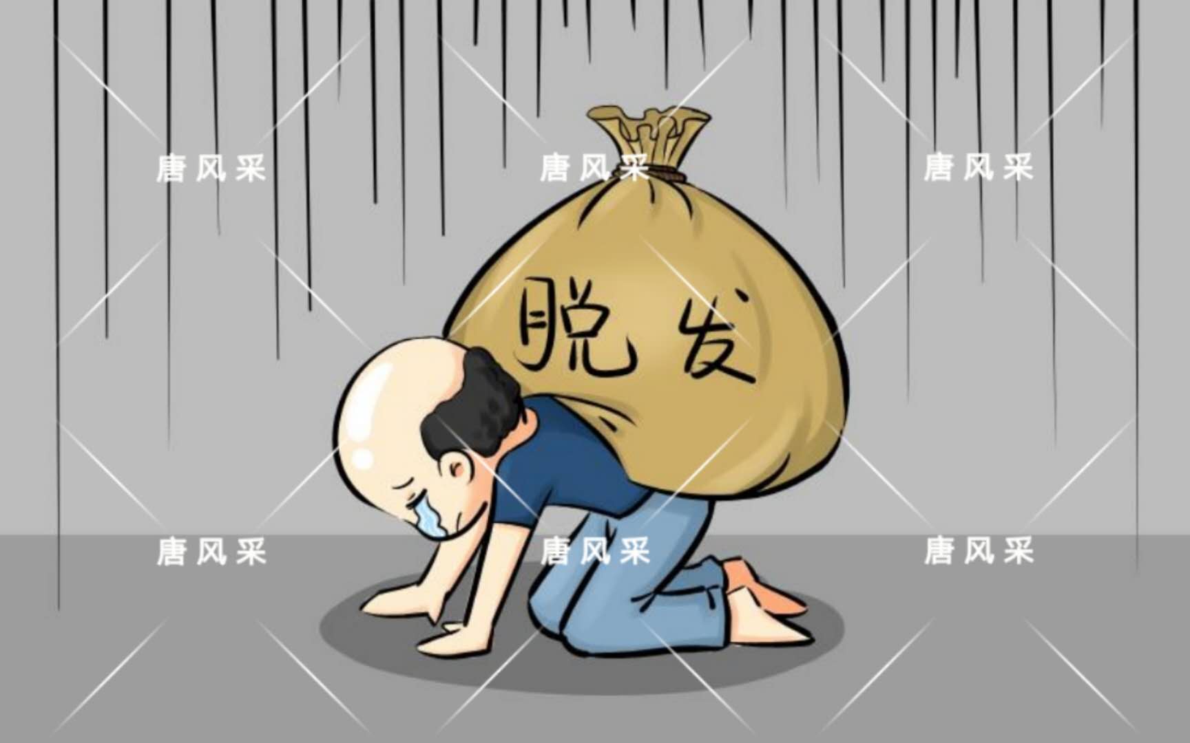 男人脫發(fā)原因多，不能一味怨腎虧！