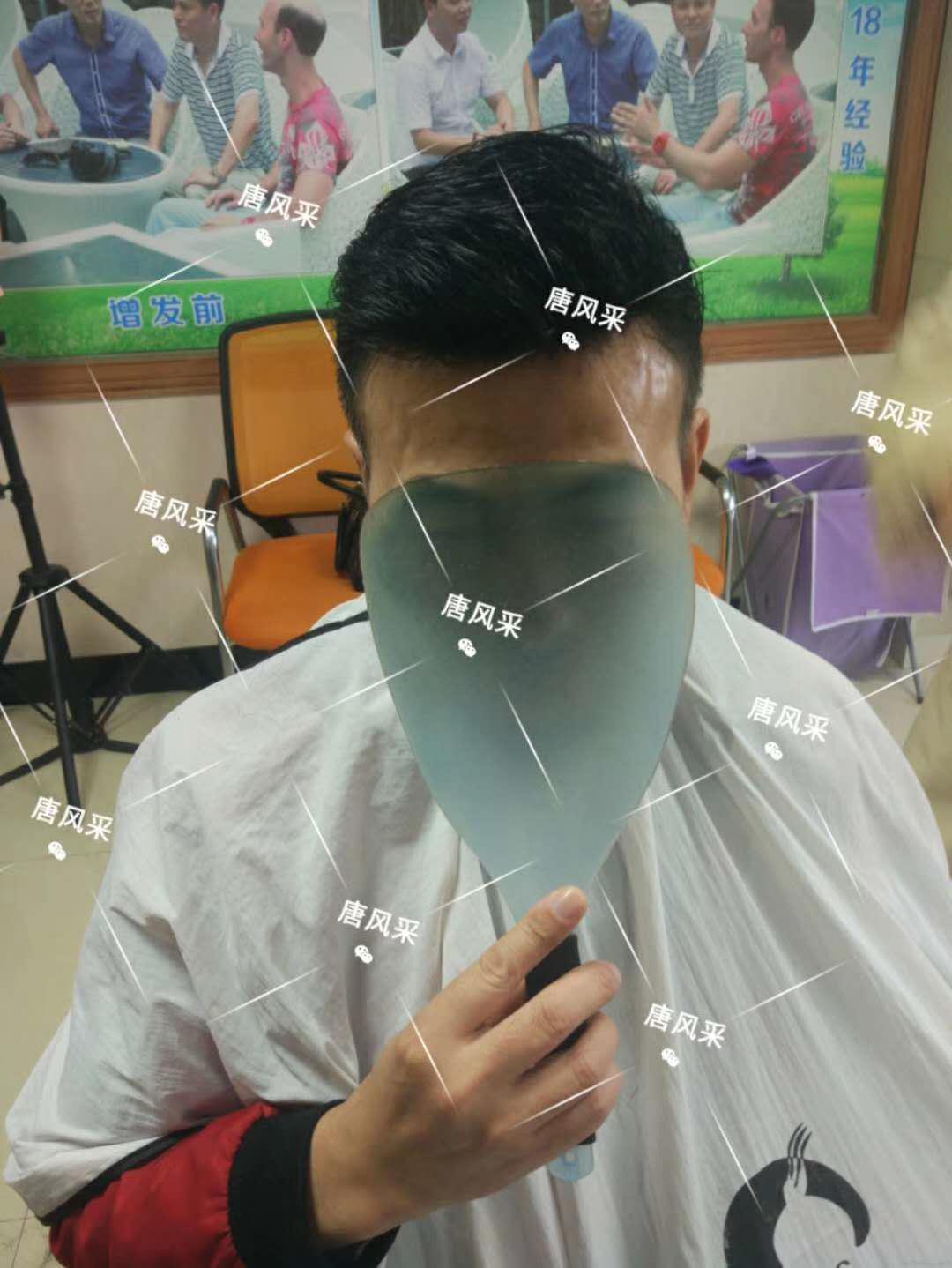 男人脫發(fā)原因多，不能一味怨腎虧！