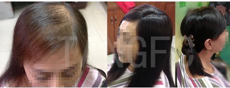 聰明的腦袋也長(zhǎng)毛，唐風(fēng)采假發(fā)來(lái)幫忙！