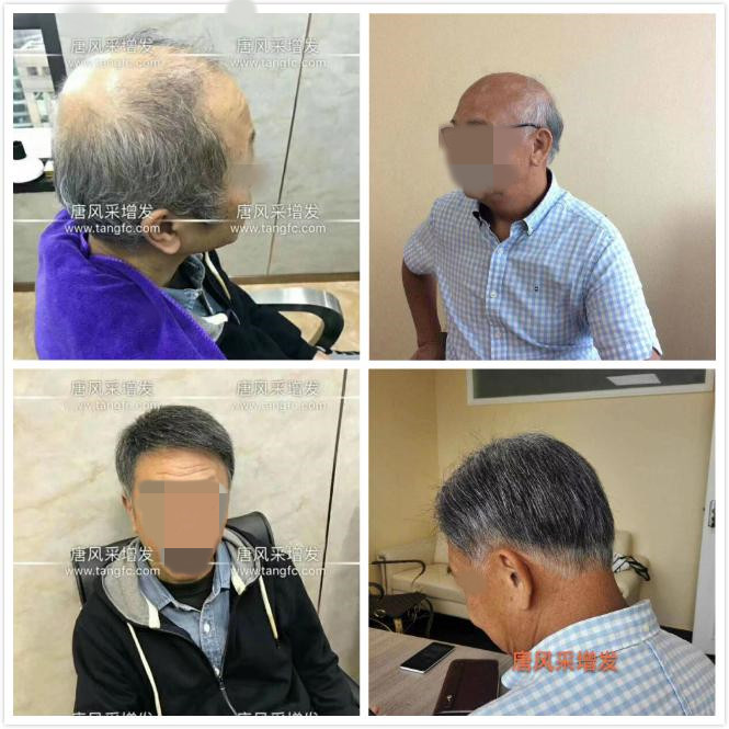 男老人假發(fā)超薄設計，這樣的逼真效果你絕對沒見過！