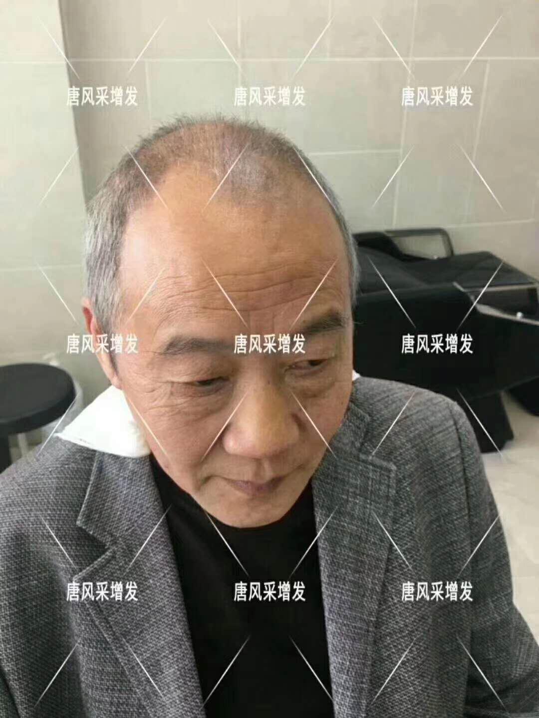 常按這個穴位好處多多 有助睡眠還能減少白頭發(fā)！