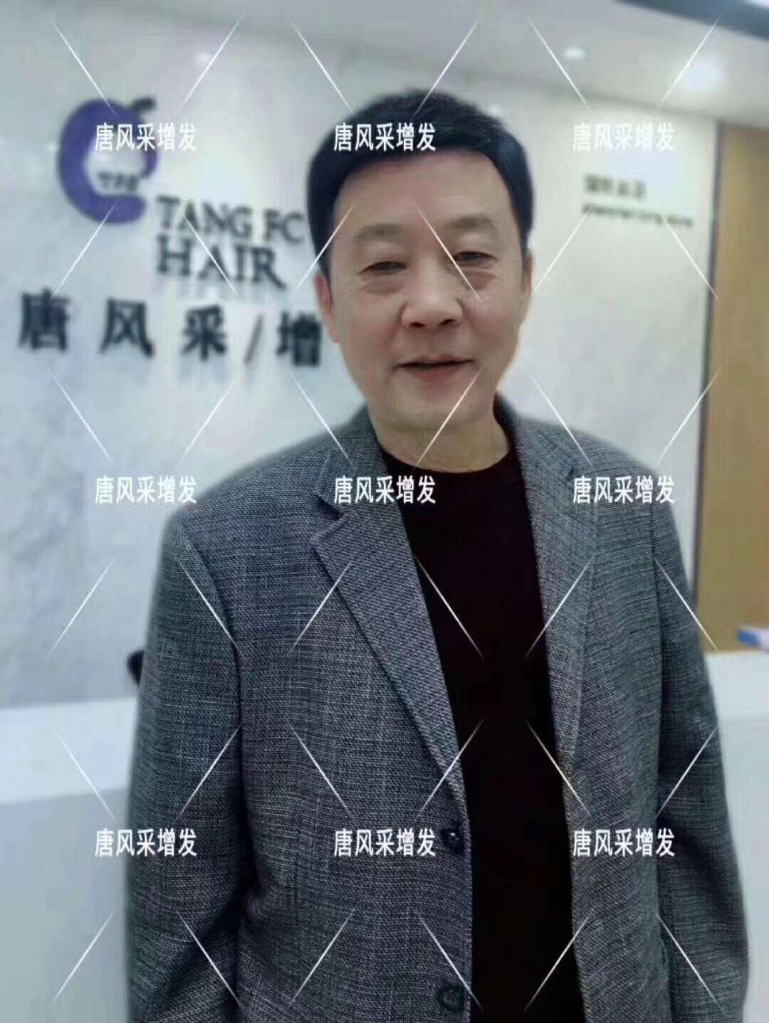 常按這個穴位好處多多 有助睡眠還能減少白頭發(fā)！