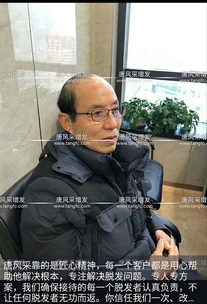 大爺大叔傻傻分不清楚？——唐風(fēng)采假發(fā)案例展示