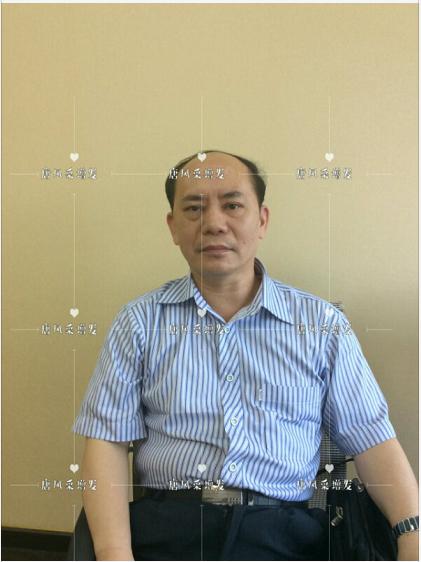 存款重要還是頭發(fā)重要？聽聽李先生怎么說！