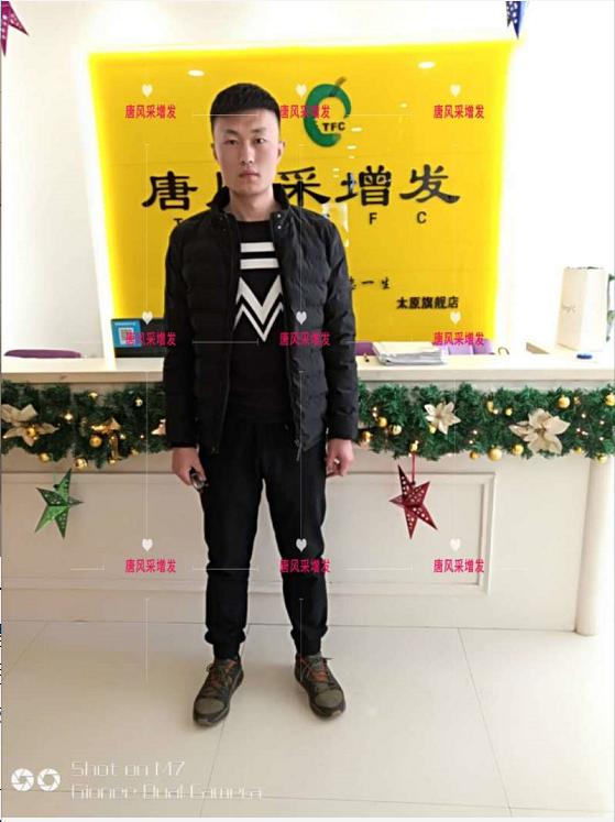 好形象擁抱新生活，唐風(fēng)采助力脫發(fā)新青年！