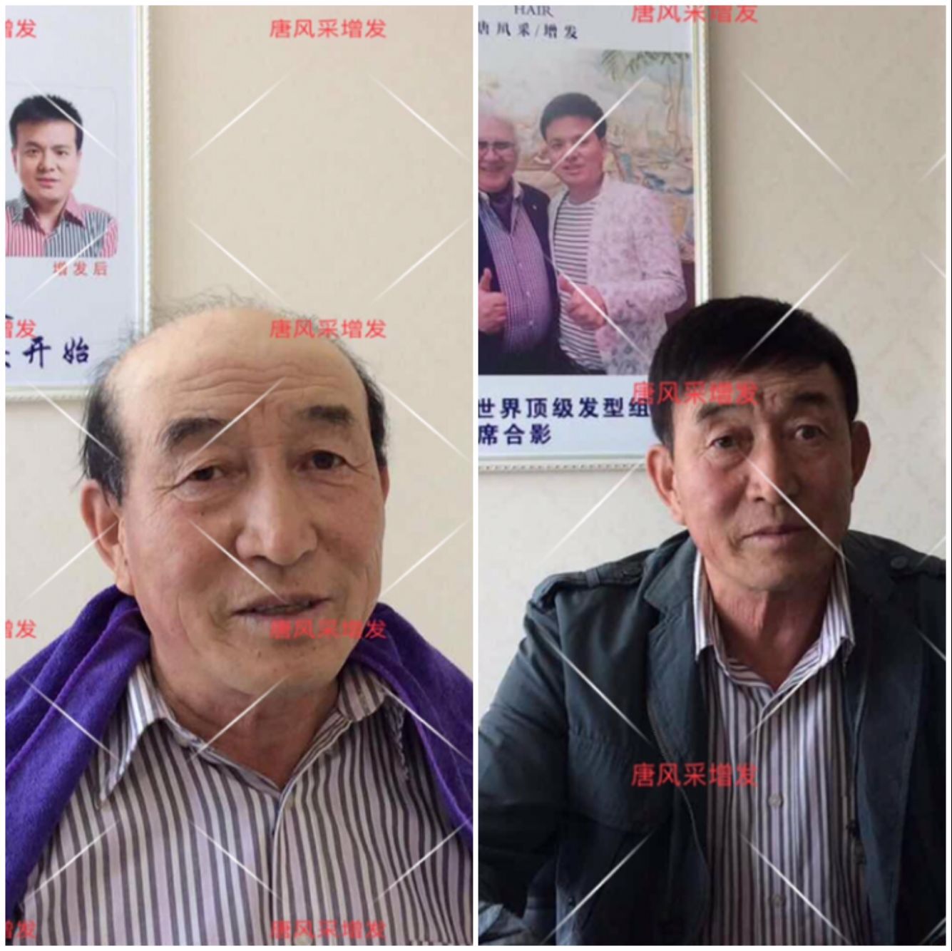 朝陽耿直大叔2年內(nèi)苦尋三次唐風(fēng)采假發(fā)，2018終于不虛此行