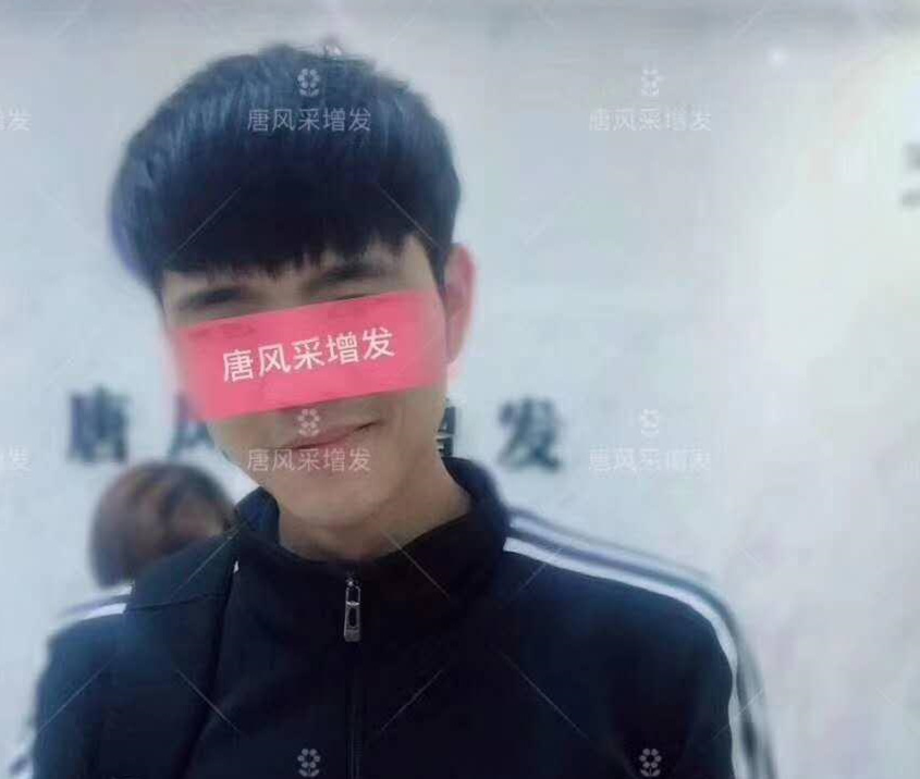 春夏季最新帥氣發(fā)型，頭發(fā)再少也能hold??！