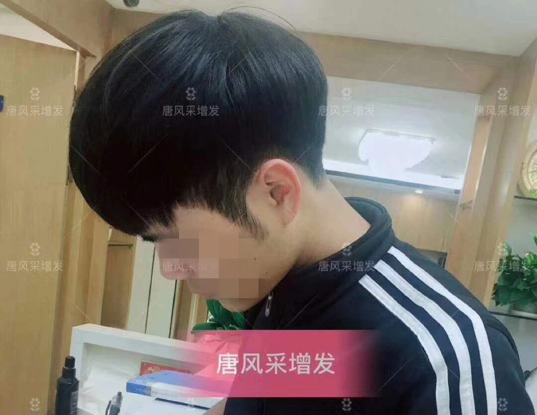 春夏季最新帥氣發(fā)型，頭發(fā)再少也能hold住！