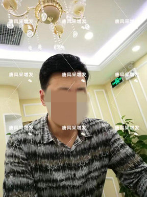 嘉興買(mǎi)隱形假發(fā)哪家好？很多人選擇嗎？