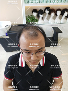 唐風(fēng)采假發(fā)效果能否達到預(yù)期？看看圖先！