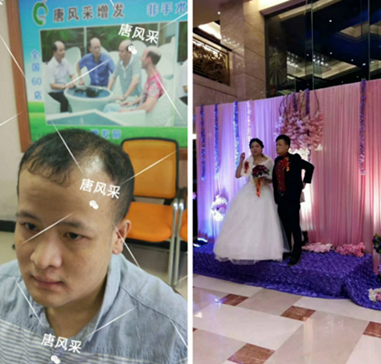 我還沒(méi)有脫單，怎么就脫發(fā)了呢?