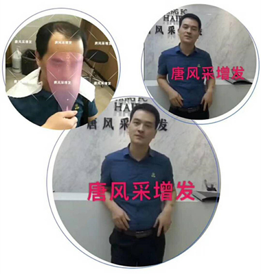 光禿禿的院子光禿禿的頭，與其羨慕不如改變！