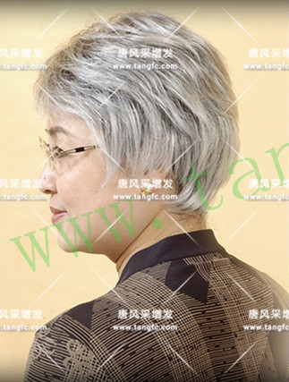 光禿禿的院子光禿禿的頭，與其羨慕不如改變！