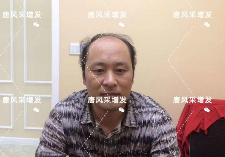 嘉興假發(fā)片定制哪家好？唐風(fēng)采假發(fā)成了首選！