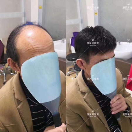 關(guān)先生增發(fā) 關(guān)先生對比照