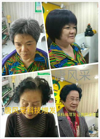 白發(fā)變黑方法介紹 增發(fā)