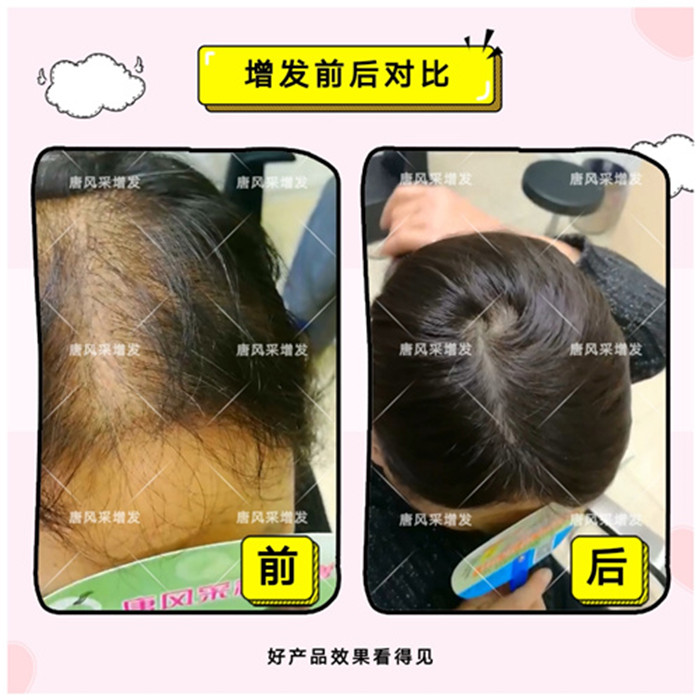 頭發(fā)稀疏！