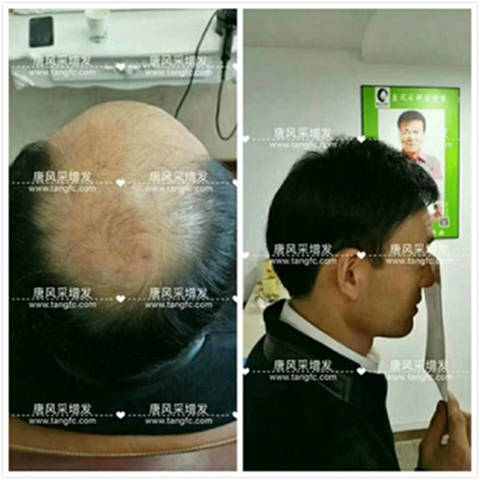 長(zhǎng)春哪里賣(mài)假發(fā)？唐風(fēng)采讓你形象更出眾