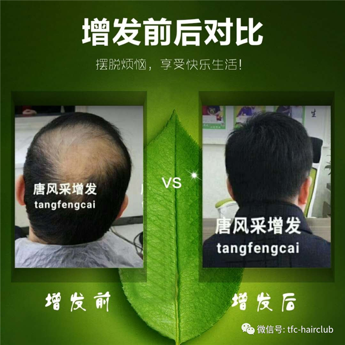 包頭哪里有真發(fā)假發(fā)套的專賣店？