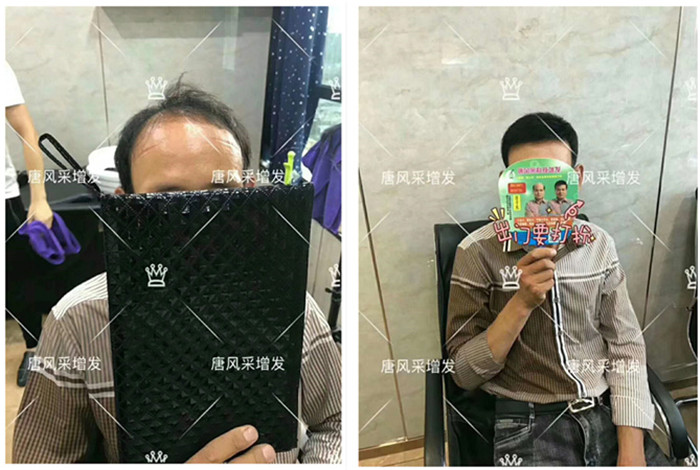 唐風(fēng)采唐山店在哪里？想要做高檔假發(fā)的發(fā)友往這看