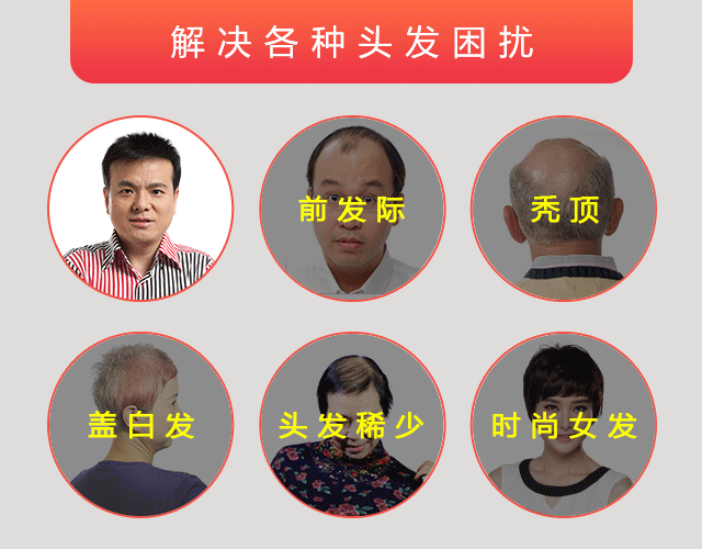 白頭發(fā)越拔越多 唐風(fēng)采假發(fā)