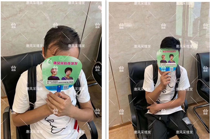 謝頂中年男 唐風(fēng)采假發(fā)后對(duì)比圖客戶