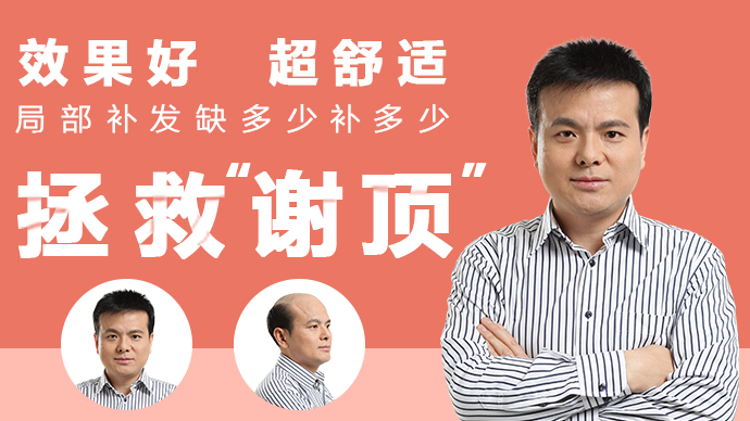 謝頂中年男 唐風(fēng)采假發(fā)