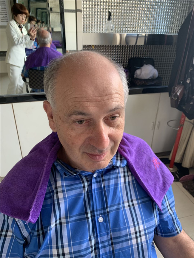 父親節(jié) 老大爺脫發(fā)40多年