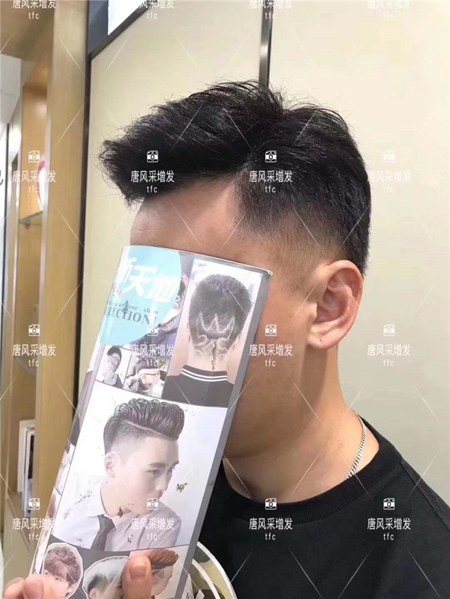 謝頂男人 在唐風(fēng)采假發(fā)后