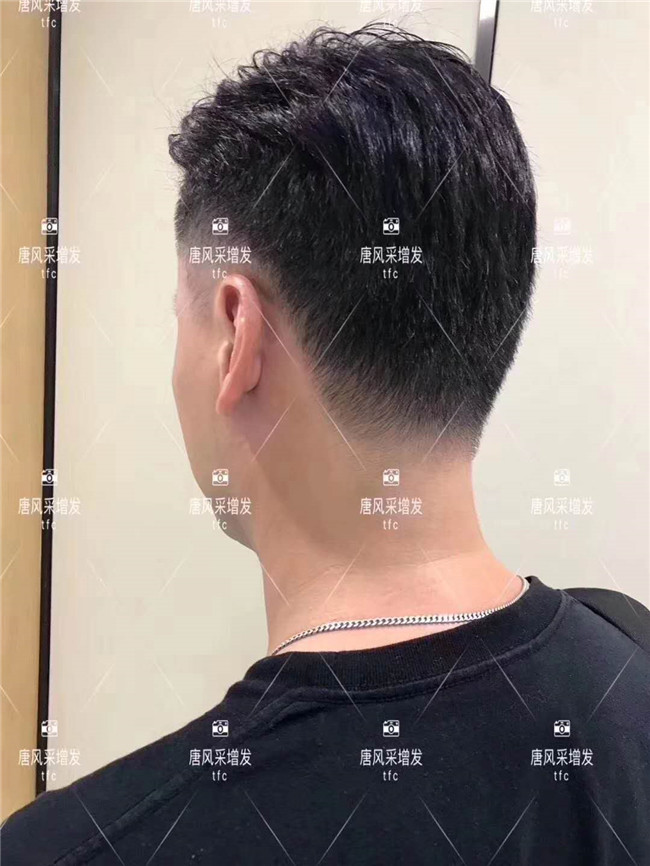 謝頂男人 在唐風(fēng)采假發(fā)后