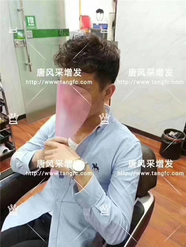 謝頂男人 卷發(fā)