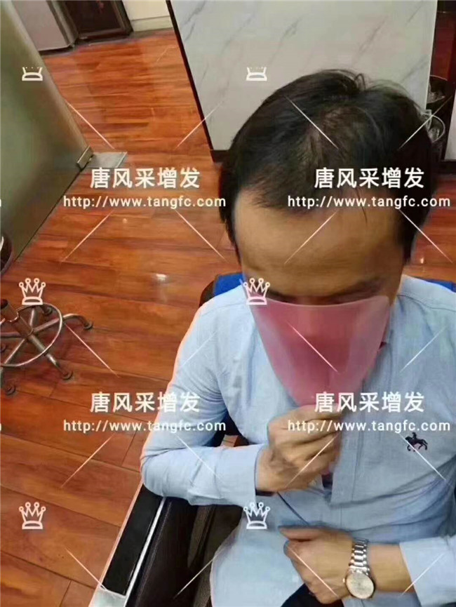 謝頂男人 卷發(fā)