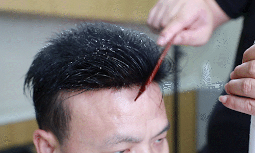 唐風(fēng)采無(wú)痕補(bǔ)發(fā)技術(shù) \