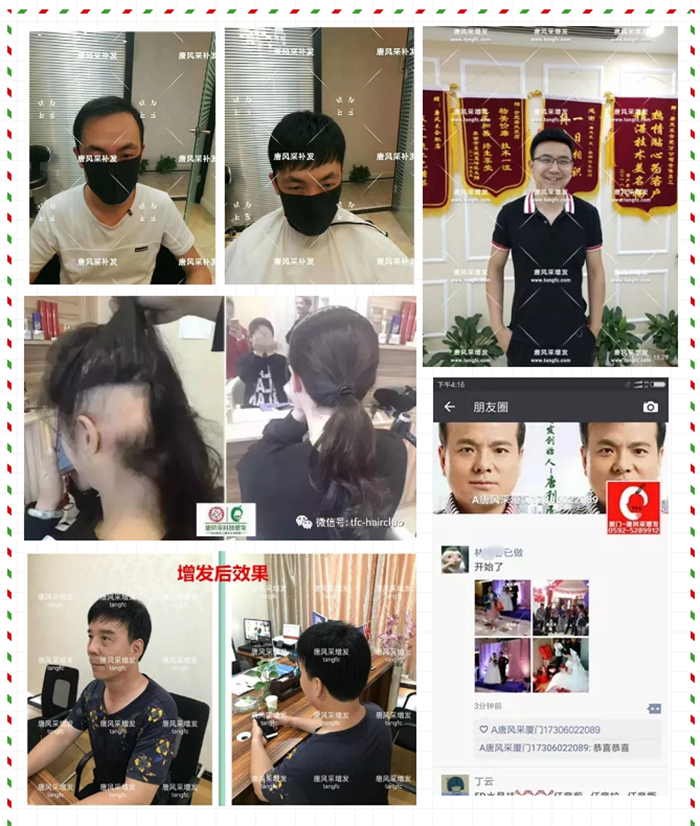 唐風(fēng)采無(wú)痕補(bǔ)發(fā)技術(shù) 唐風(fēng)采假發(fā)