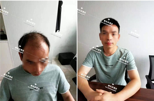 唐風(fēng)采無(wú)痕補(bǔ)發(fā)技術(shù) 唐風(fēng)采假發(fā)