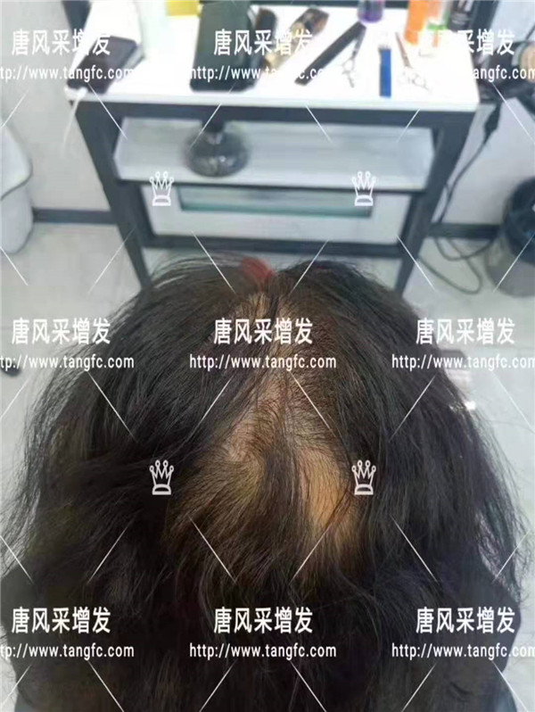 時尚假發(fā) 官方二維碼 唐風(fēng)采無痕假發(fā)