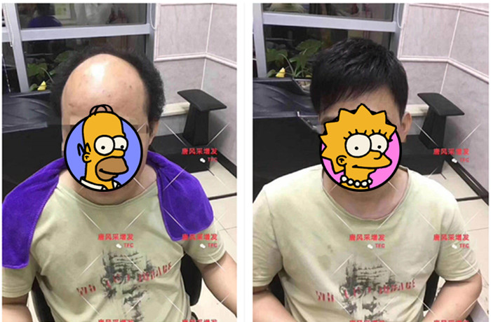 唐風采真實案例