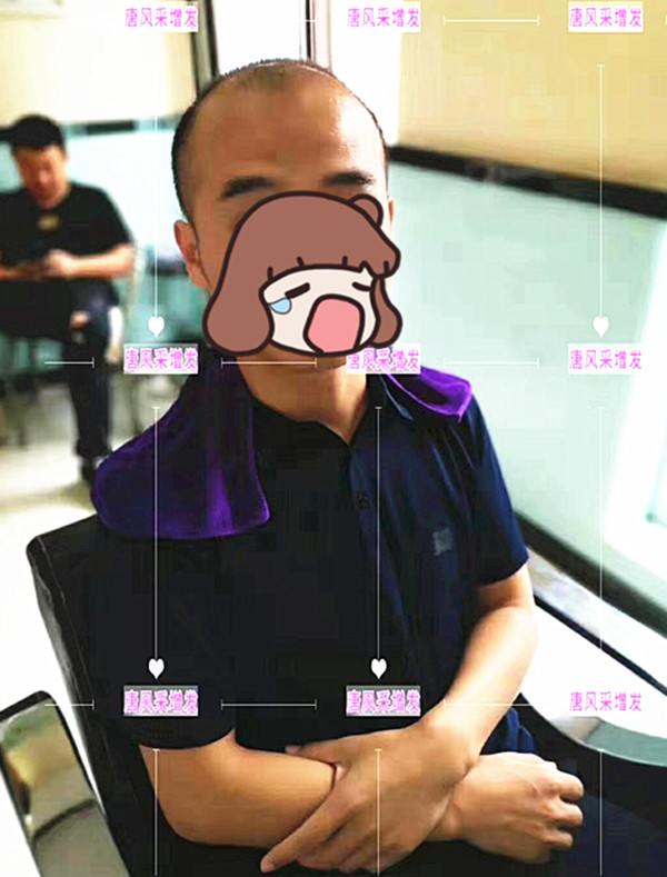 唐風采真實案例