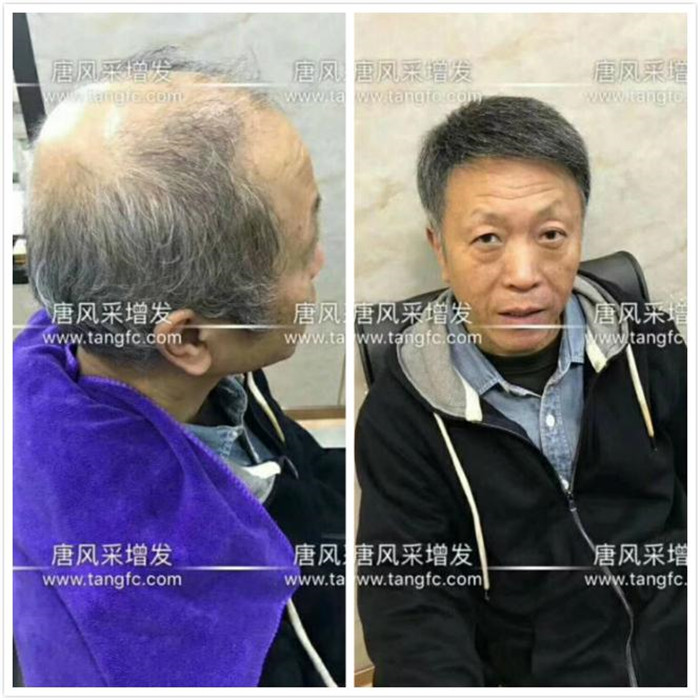 附近假發(fā)店 唐風(fēng)采真實案例