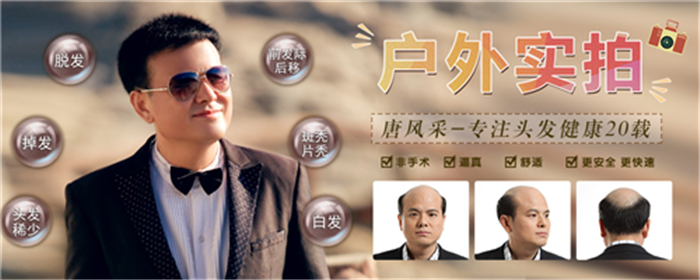 真發(fā)假發(fā)專賣店 唐風(fēng)采高檔假發(fā)售后服務(wù)