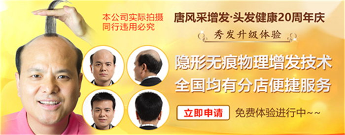 如何解決地中海脫發(fā) 唐風(fēng)采假發(fā)